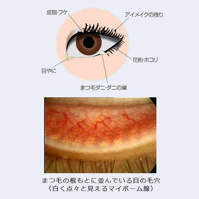 目にしみにくい目元専用シャンプー「アイシャンプープロ(大容量200ml)」 - 望月メディカルネット