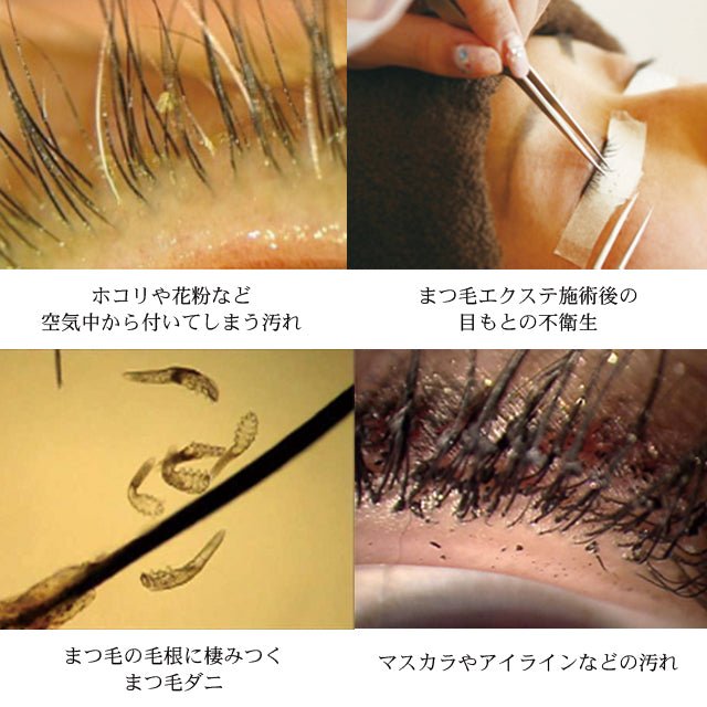 メントール配合で爽快感抜群の目元専用シャンプー「アイシャンプーリフレッシュ(95ml)」 - 望月メディカルネット