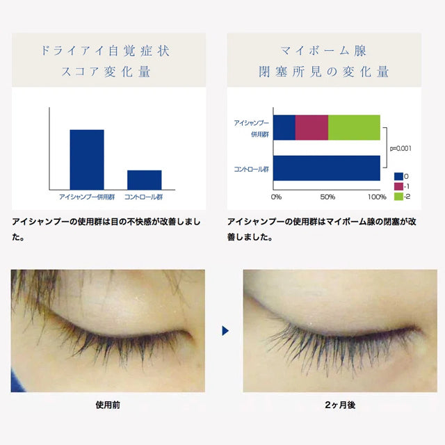 まつ毛までケアする美容発想の目もと専用シャンプー「アイシャンプービューティ」